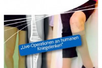 Prof. Hinterwimmer mit Vortrag und Demo-OP beim AO-Trauma-Kniekurs in Hamburg